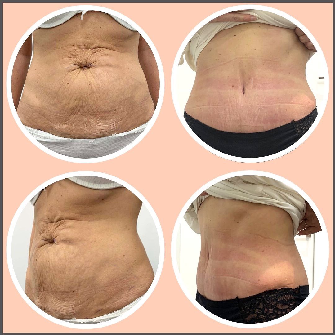 83377070_2267672573332762_7207180294938427392_n