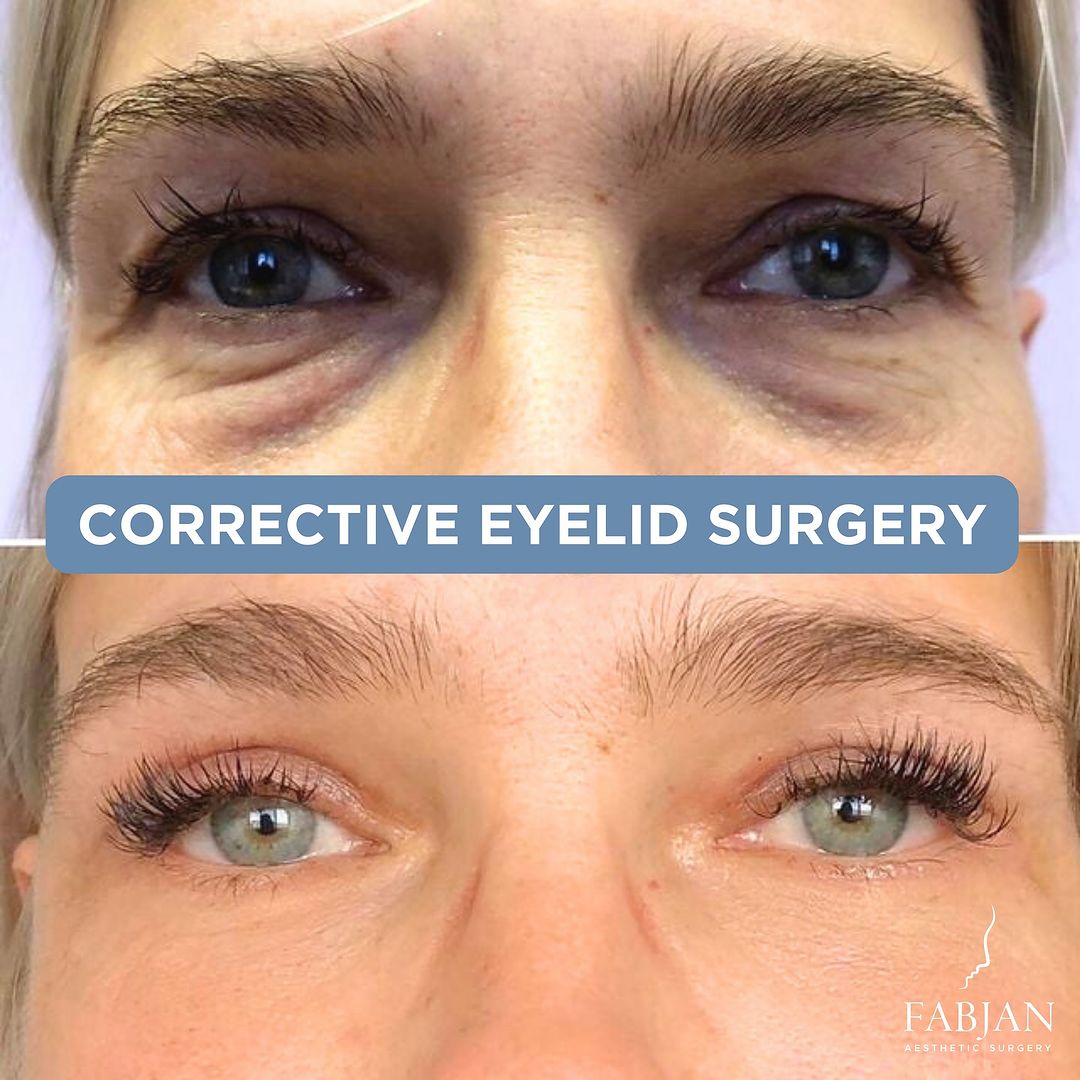 Snapinsta.app_424735777_17905039031926531_5895996786126623359_n_1080