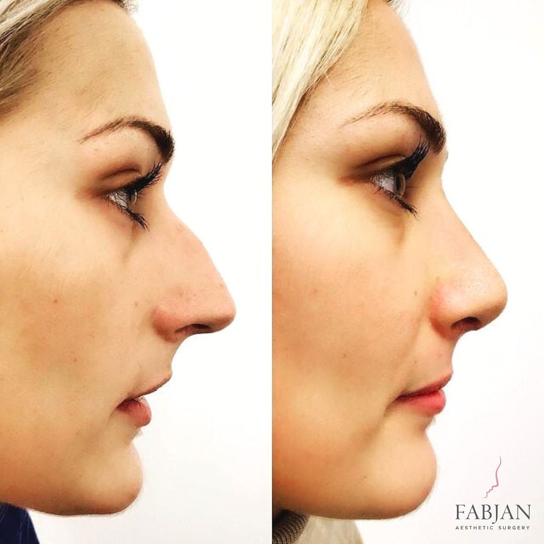 Snapinsta.app_430102994_122124957278202652_9048614102730864942_n_1080