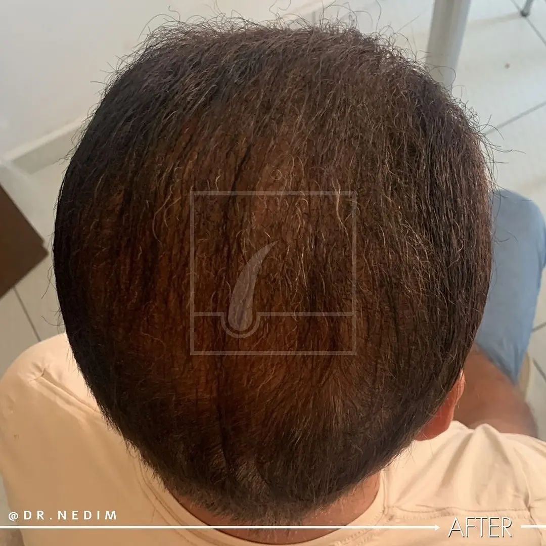 Snapinsta.app_431116256_429963282713874_1287171307840329336_n_1080