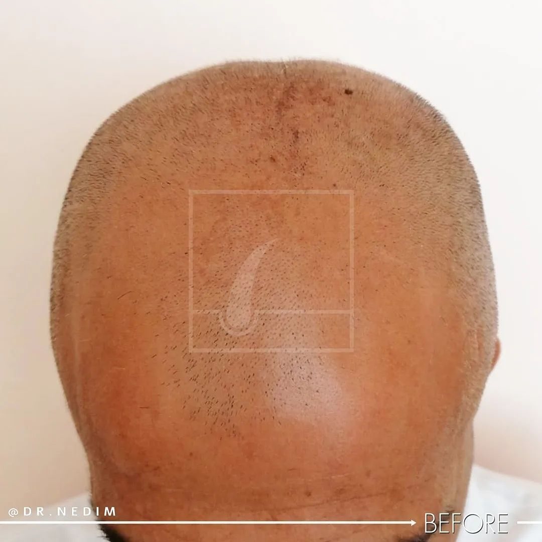 Snapinsta.app_431141008_326371227103445_8161109870700734958_n_1080