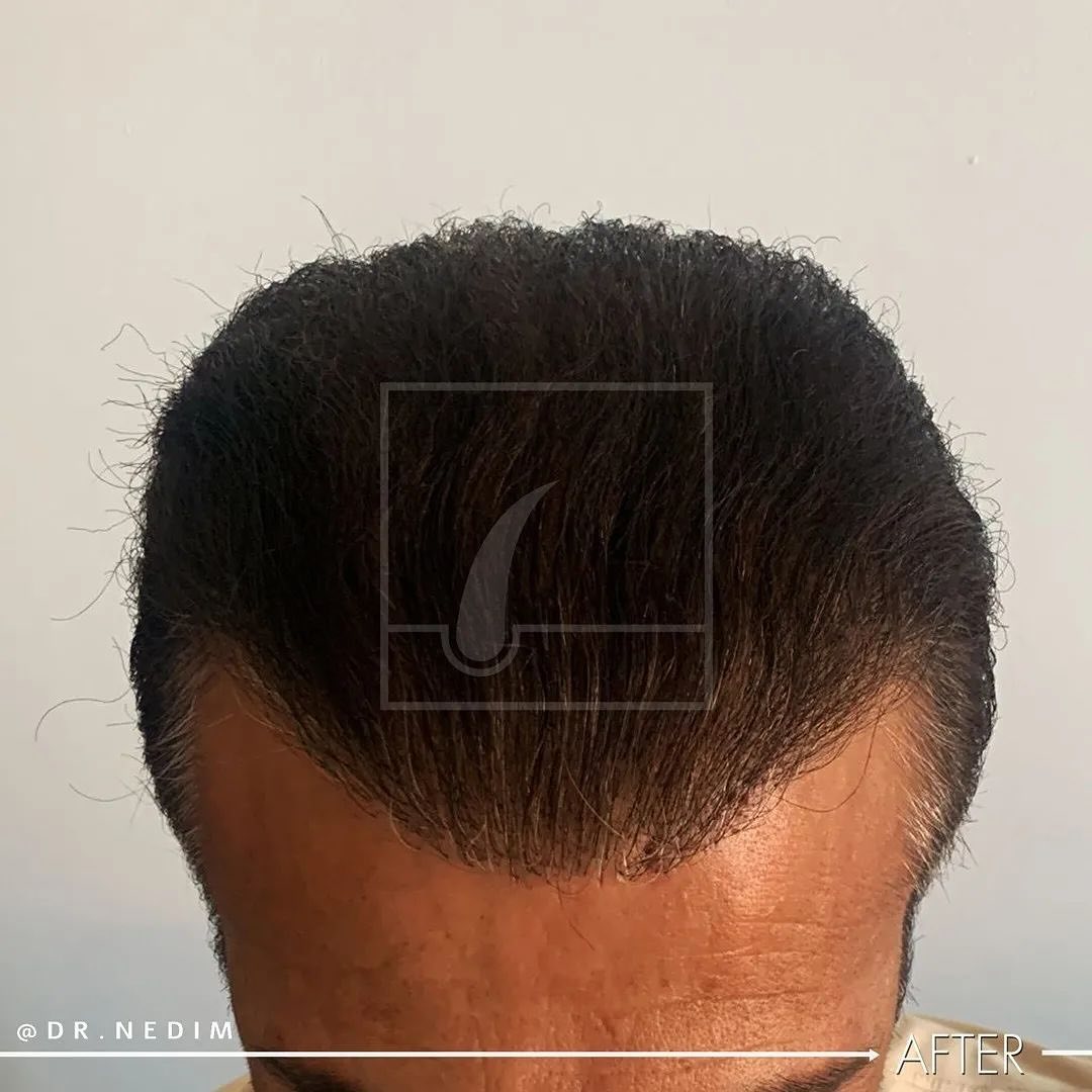 Snapinsta.app_431147754_916689003281875_3099776274494307186_n_1080