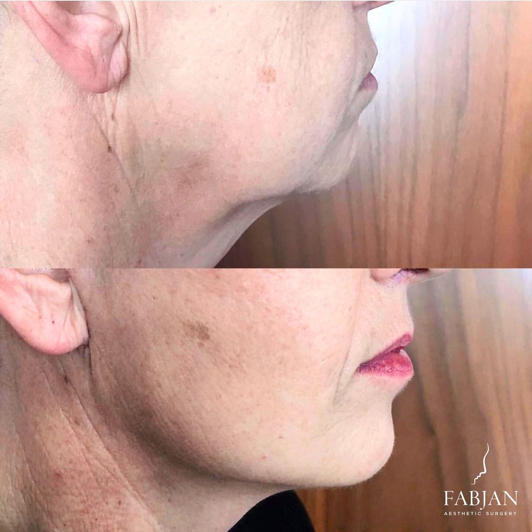 Snapinsta.app_431285884_634122342188581_3567360290305266310_n_1080