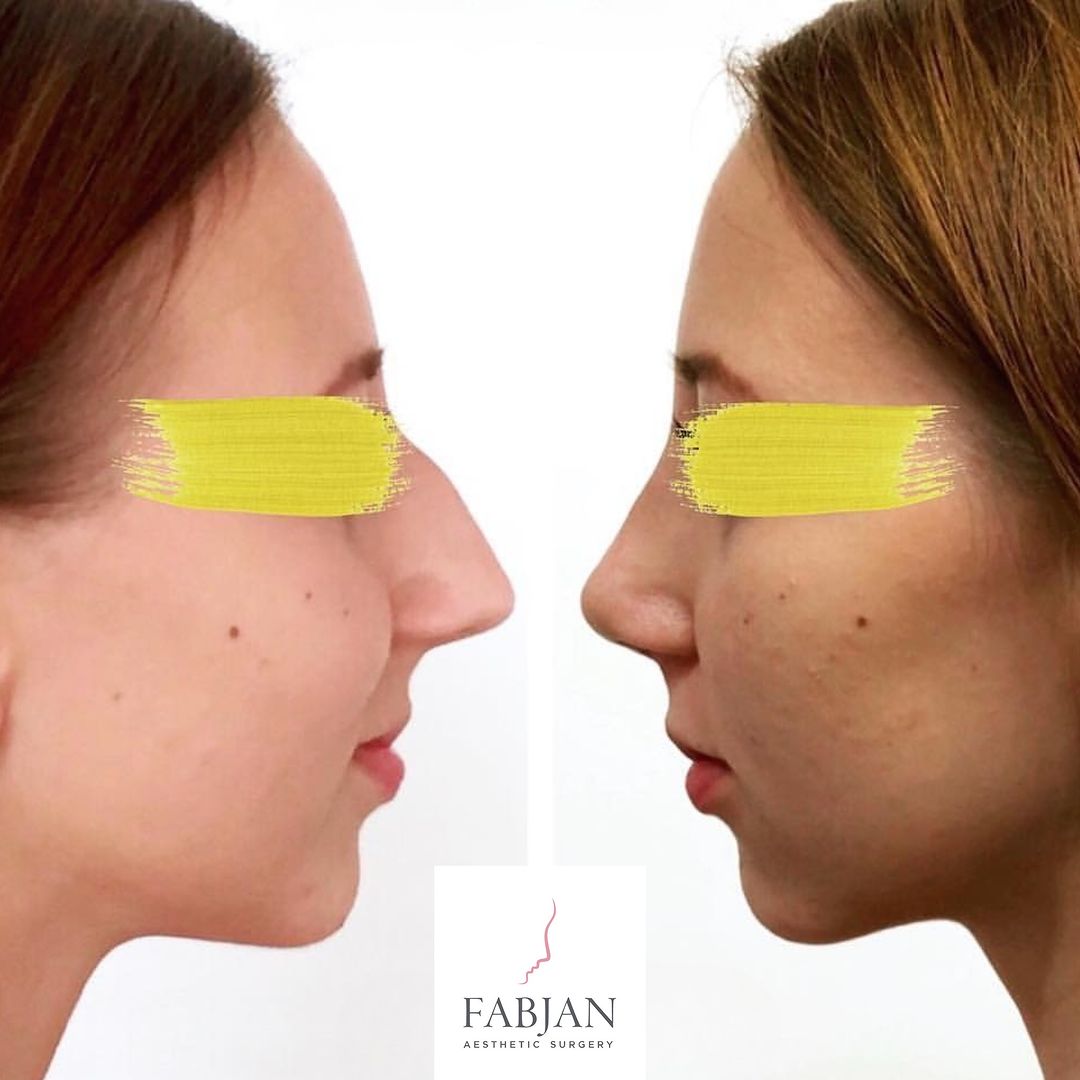 Snapinsta.app_431492479_122129454116202652_3301975659861699875_n_1080