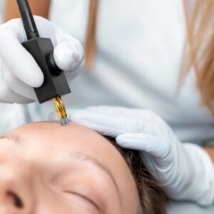 Close-up beautician doctor hand making anti-age face remodel procedure treatment with hardware microcurrent electric tool attractive young 30-40 female model at beauty clinic. Cosmetologist skincare.