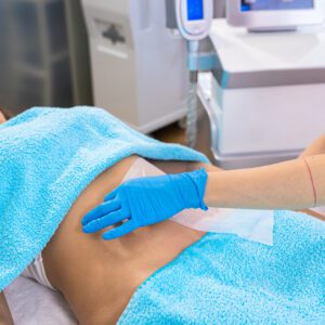 Beautician therapist applying cryolipolysis treatment in beauty salon.