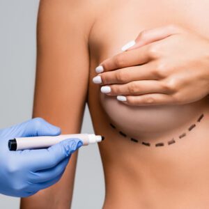 Cropped view of doctor in latex glove holding marker near naked woman with marks on breast isolated