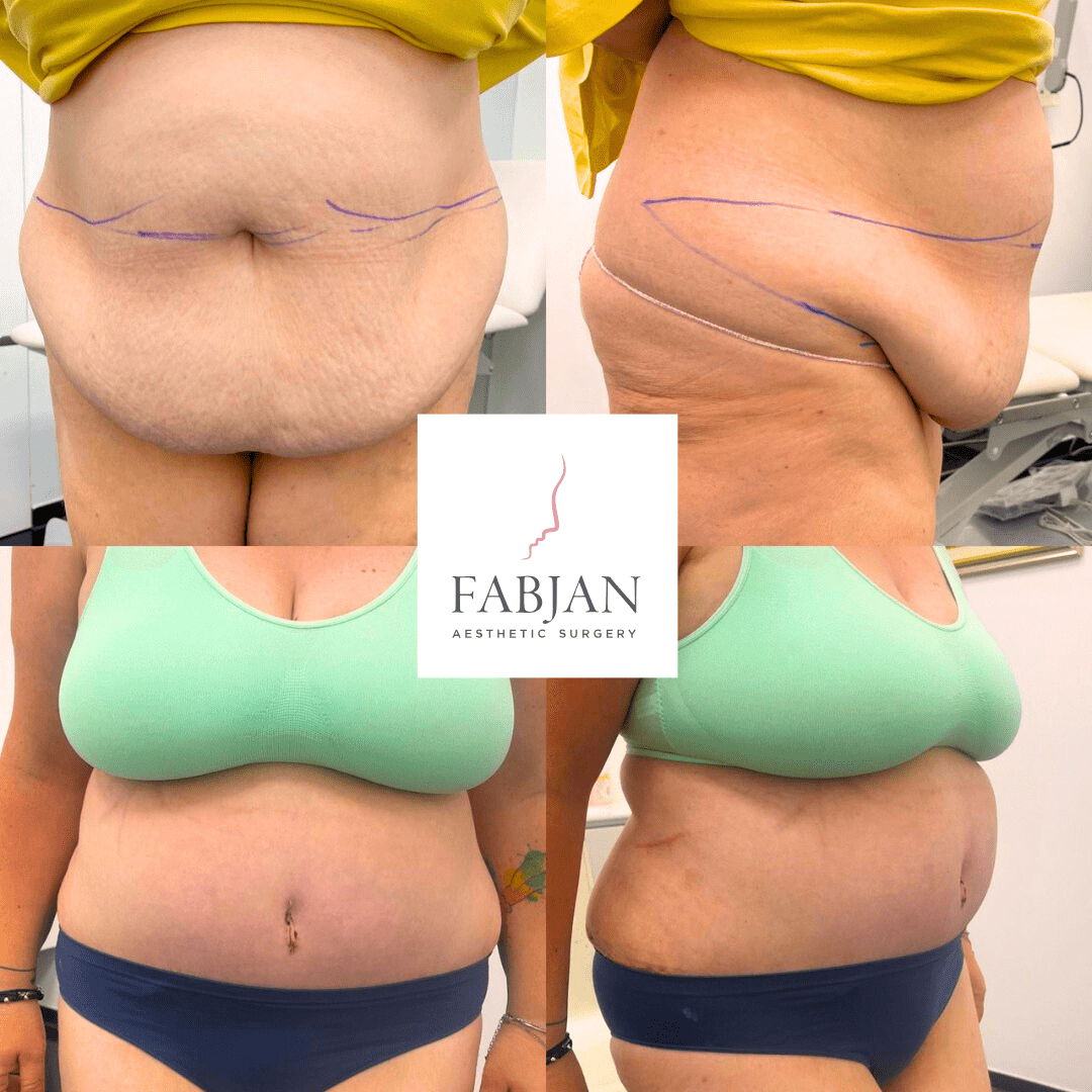 How-to-know-if-you-are-a-candidate-for-botox-38-min